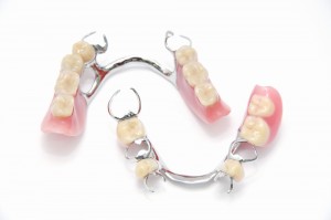 Options for Replacing a Lost Tooth
