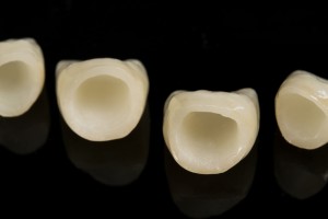 Dental Crowns for Both Cosmetic and Oral Health Concerns